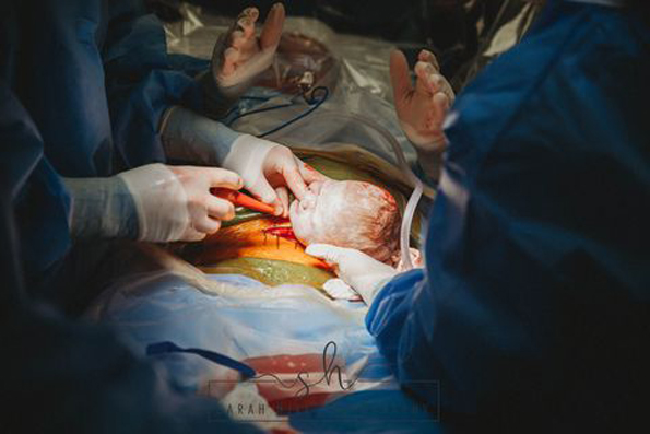 Неверојатни фотографии: Оваа жена активно учествувала во нејзиното породување со царски рез