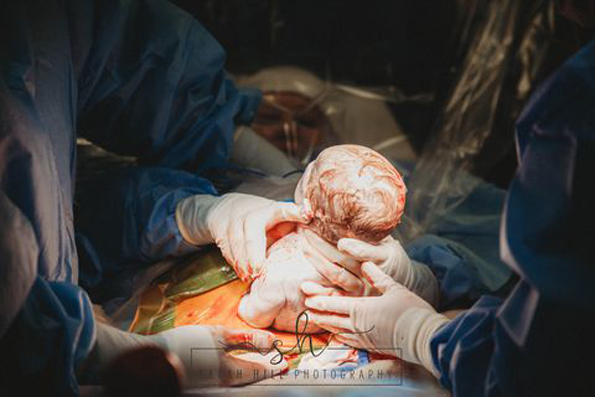 Неверојатни фотографии: Оваа жена активно учествувала во нејзиното породување со царски рез