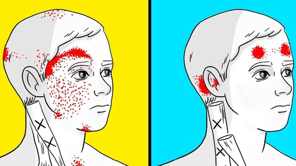7 грешки во исхраната што можат да предизвикаат силни главоболки и мигрени