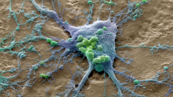 Зошто сè уште немаме пронајдено лек за рак?