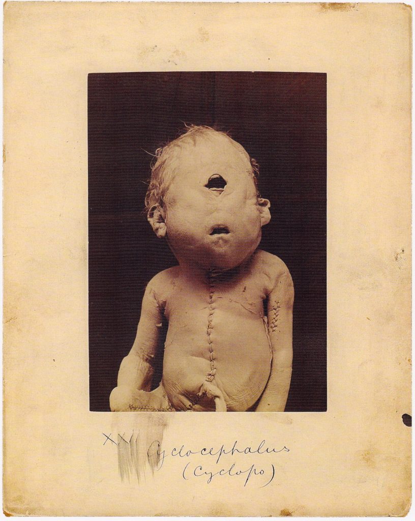 10 вознемирувачки медицински фотографии од минатото
