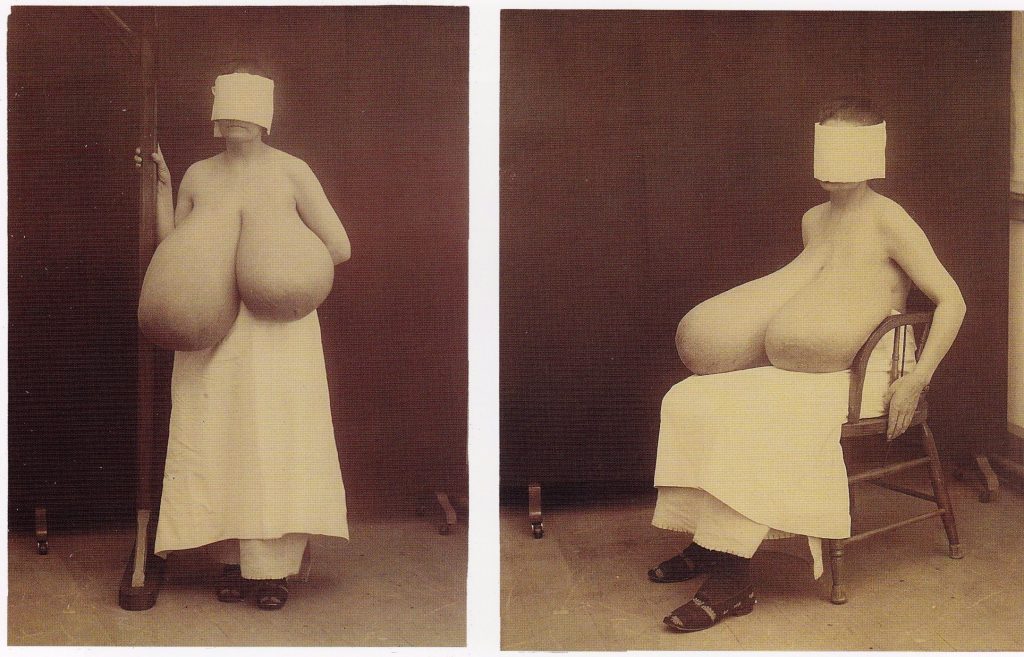 10 вознемирувачки медицински фотографии од минатото