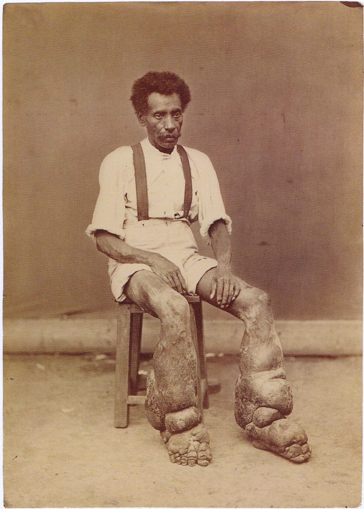 10 вознемирувачки медицински фотографии од минатото