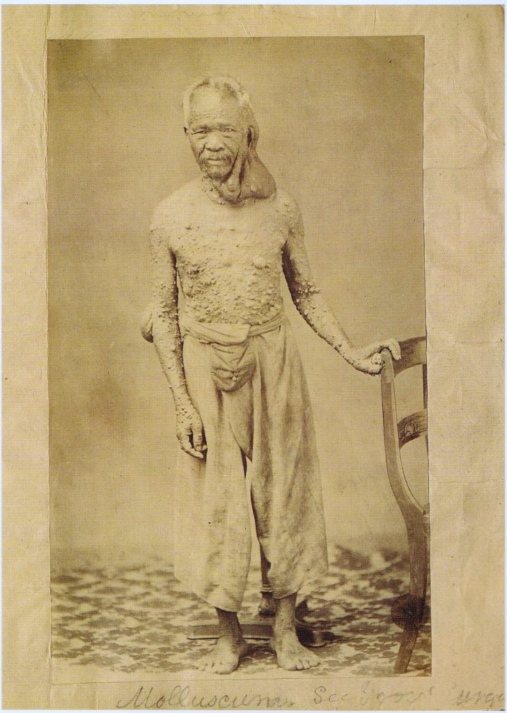 10 вознемирувачки медицински фотографии од минатото