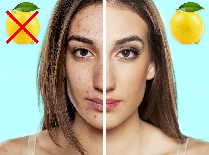 9 примени на лимонот во третманите за здравје и убавина