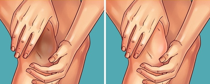 10 трикови за природно отстранување на темната кожа од колената и лактите