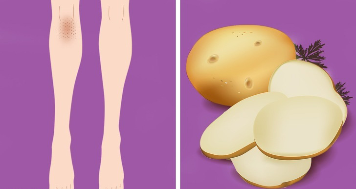 10 трикови за природно отстранување на темната кожа од колената и лактите