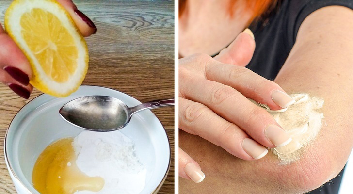 10 трикови за природно отстранување на темната кожа од колената и лактите