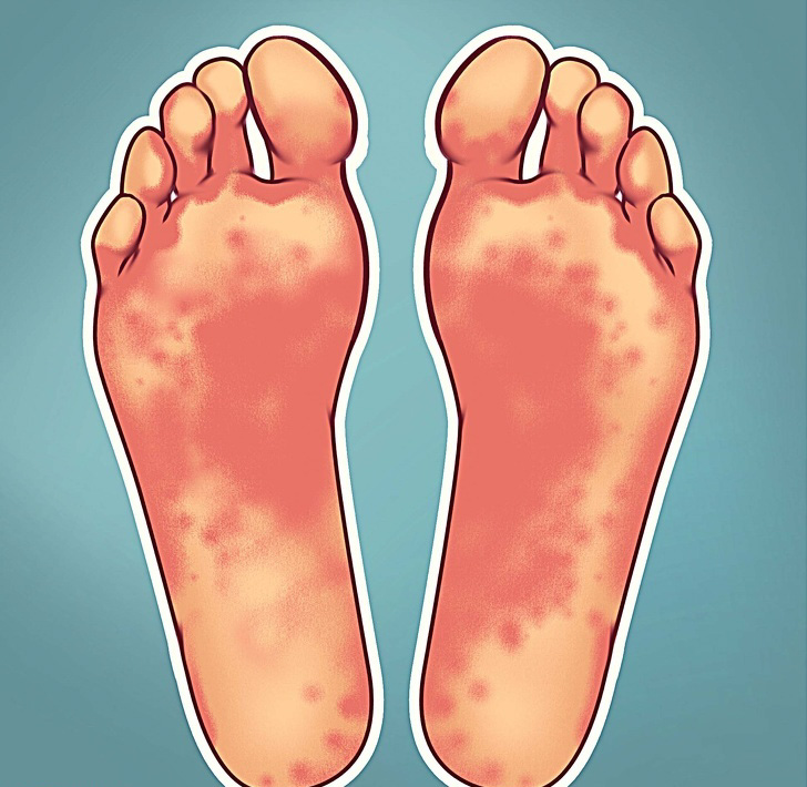 Проблеми со здравјето што можете да ги откриете од вашите стапала