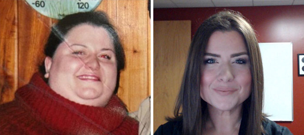 Луѓето на овие 20 „пред и потоа“ фотографии екстремно го намалиле вишокот килограми и ќе ве мотивираат и вас да успеете во тоа