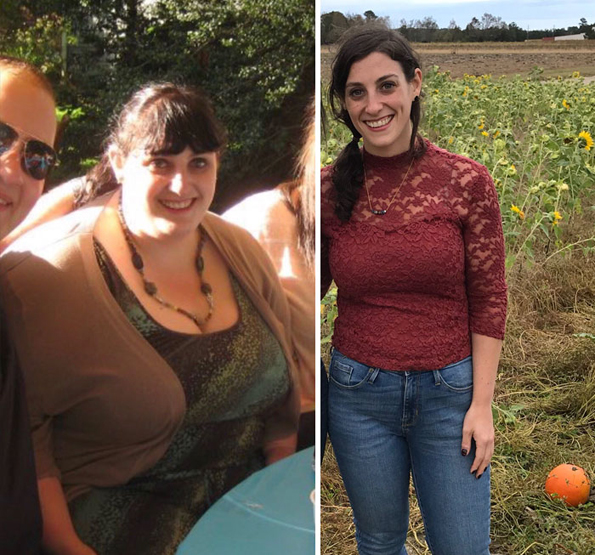 Луѓето на овие 20 „пред и потоа“ фотографии екстремно го намалиле вишокот килограми и ќе ве мотивираат и вас да успеете во тоа