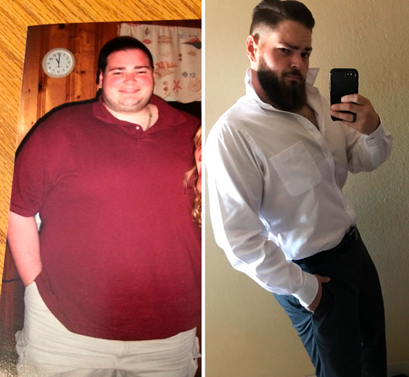 Луѓето на овие 20 „пред и потоа“ фотографии екстремно го намалиле вишокот килограми и ќе ве мотивираат и вас да успеете во тоа
