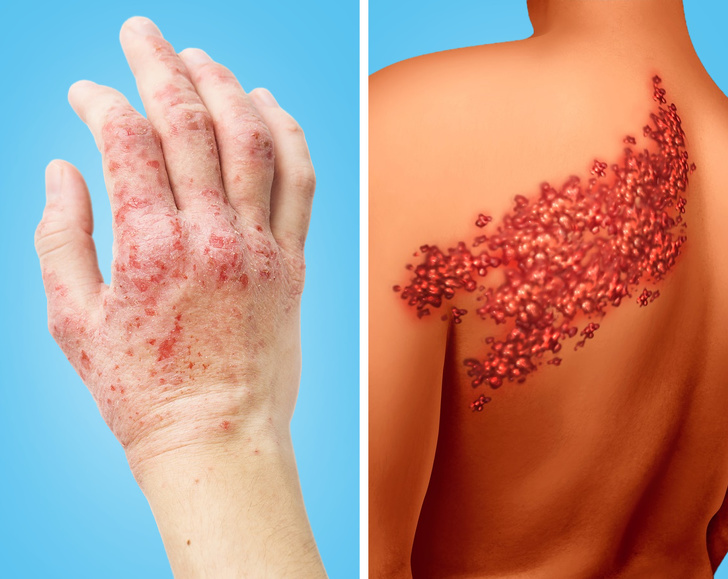 8 предупредувачки знаци дека вашето срце на работи како што треба