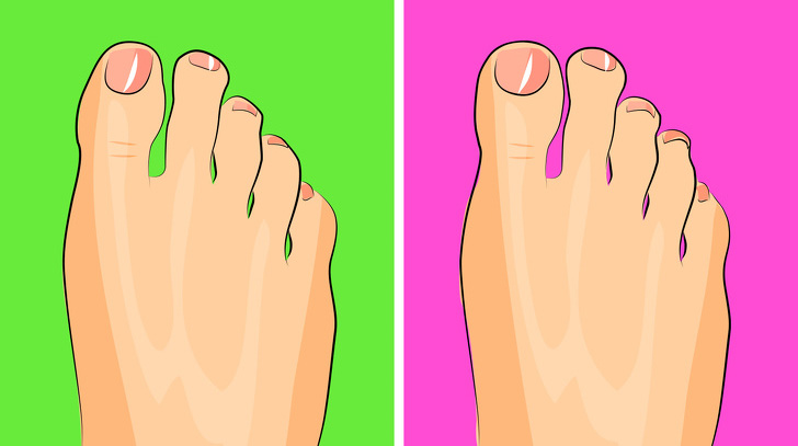 Проблеми со здравјето што можете да ги откриете од вашите стапала