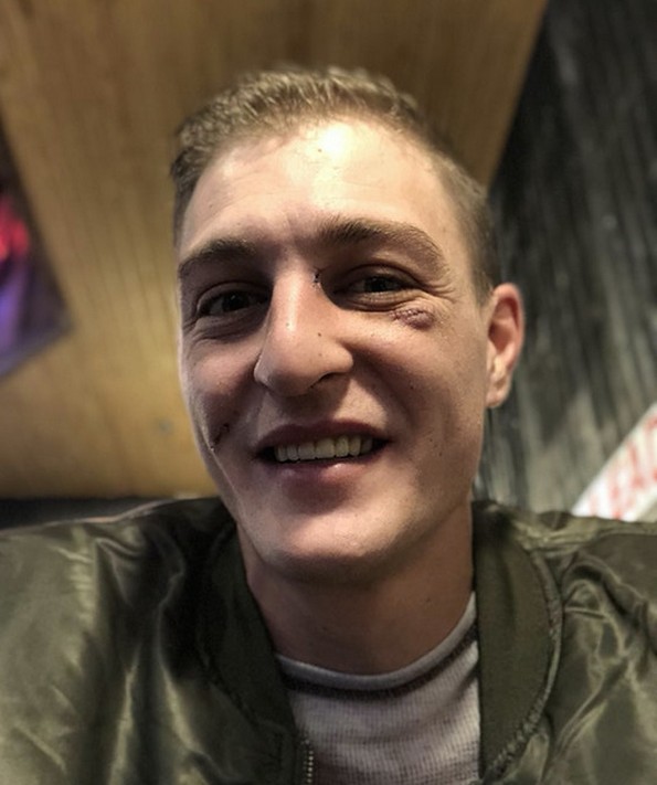 27 луѓе покажуваат како изгледа висинската среќа