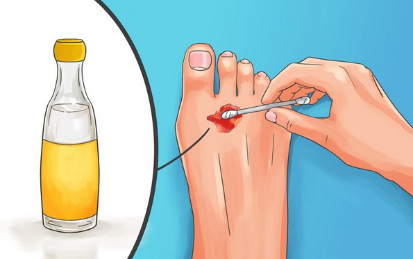 10 неочекувани примени на секојдневни предмети што можат да ви го спасат животот