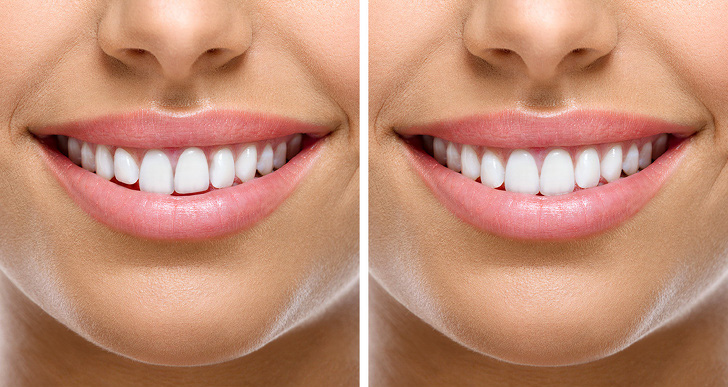 Научниците објаснуваат: Зошто кожата на лицето почнува да старее рано и како да го спречите тоа?