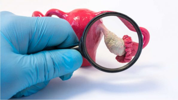 Нов вештачки јајник можеби е решението за неплодност по рак