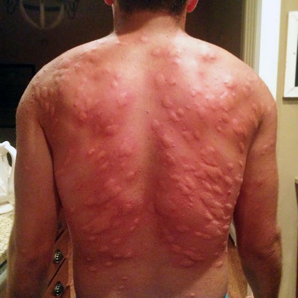 Фотографии што ги прикажуваат смешните последици од заборавањето