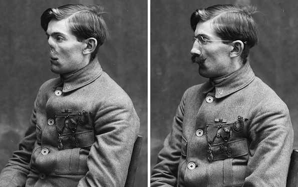 Неверојатни „реконструкции“ на лице на војници од Првата светска војна