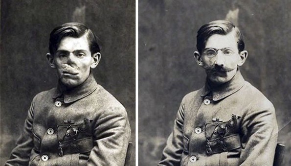 Неверојатни „реконструкции“ на лице на војници од Првата светска војна