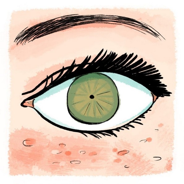 14 симптоми на топлотен удар на кои треба да обрнете внимание