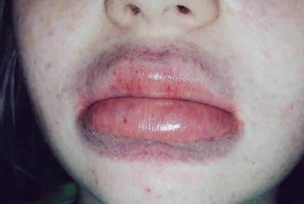 Вознемирувачки Интернет трендови што предизвикале повреди и несреќи