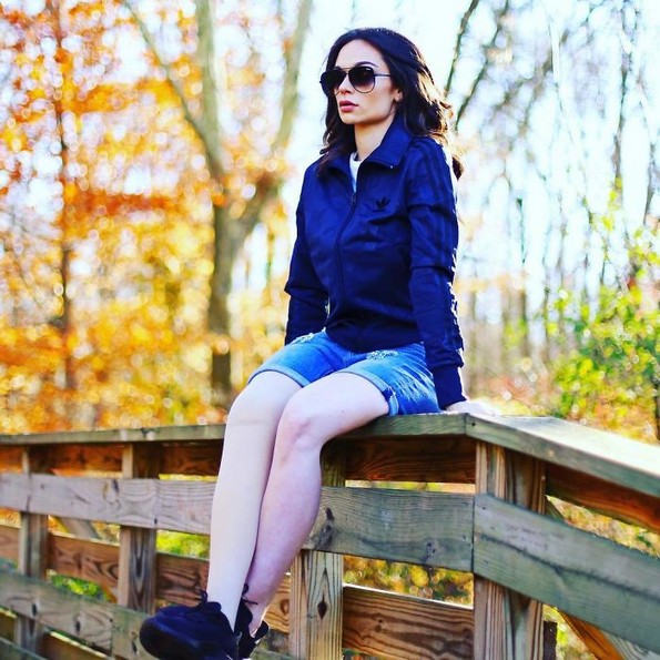 Девојче со ампутирана нога станува модел 20 години подоцна