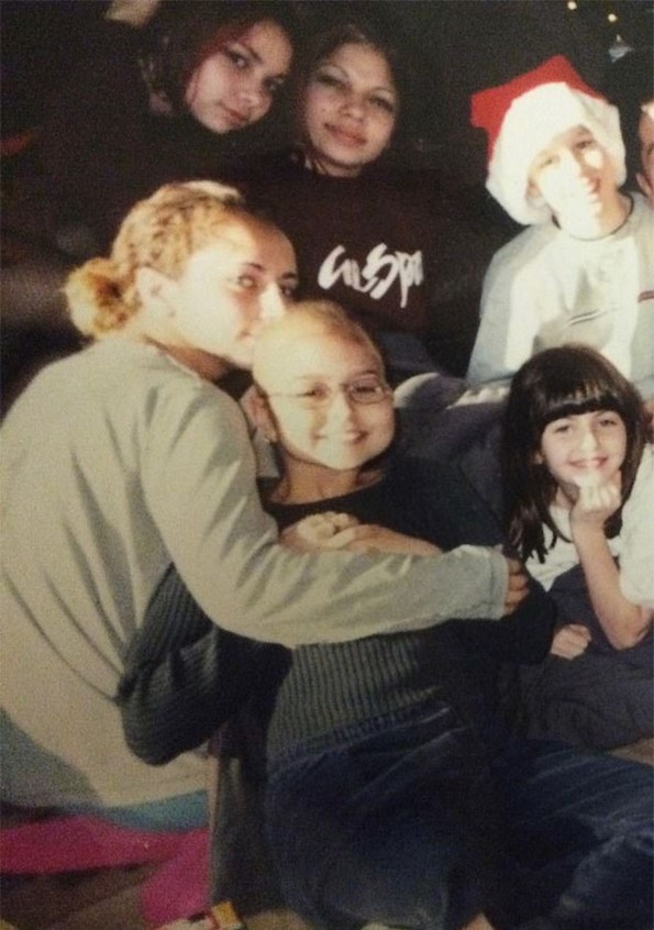 Девојче со ампутирана нога станува модел 20 години подоцна