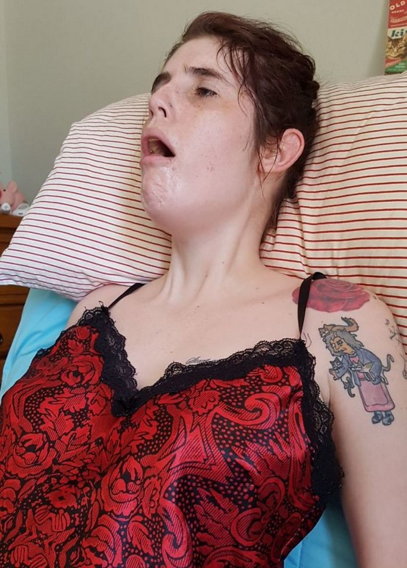 27-годишна девојка која се залага за легализација на еутаназија покажала како изгледа животот со инвалидитет