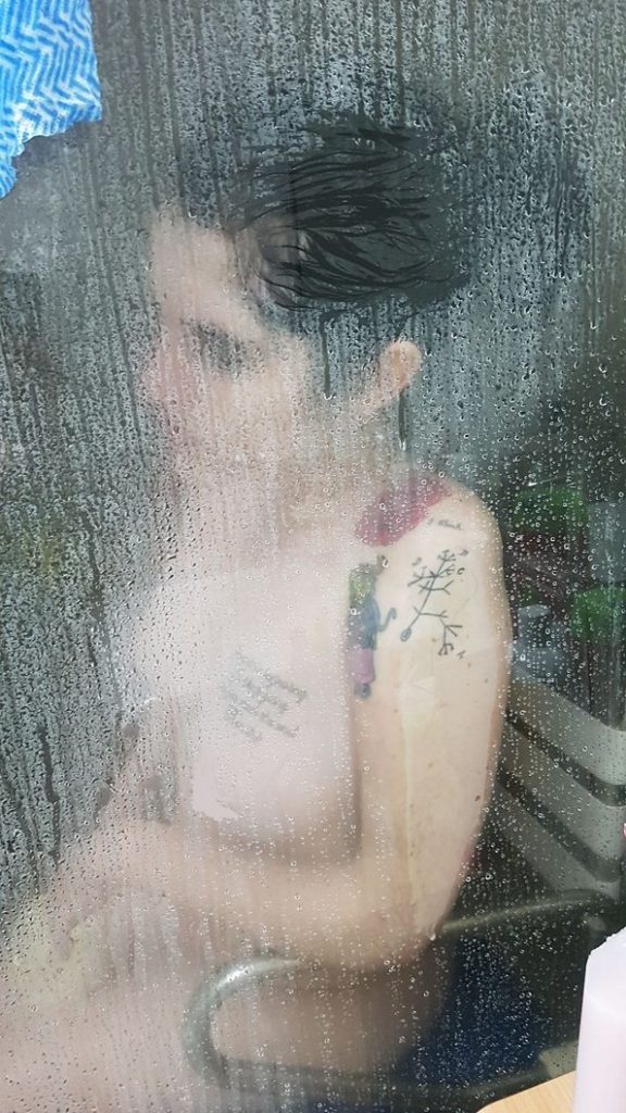 27-годишна девојка која се залага за легализација на еутаназија покажала како изгледа животот со инвалидитет