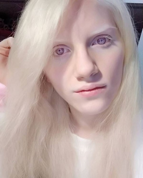 Луѓе споделуваат фотографии од нивните необични делови на телото