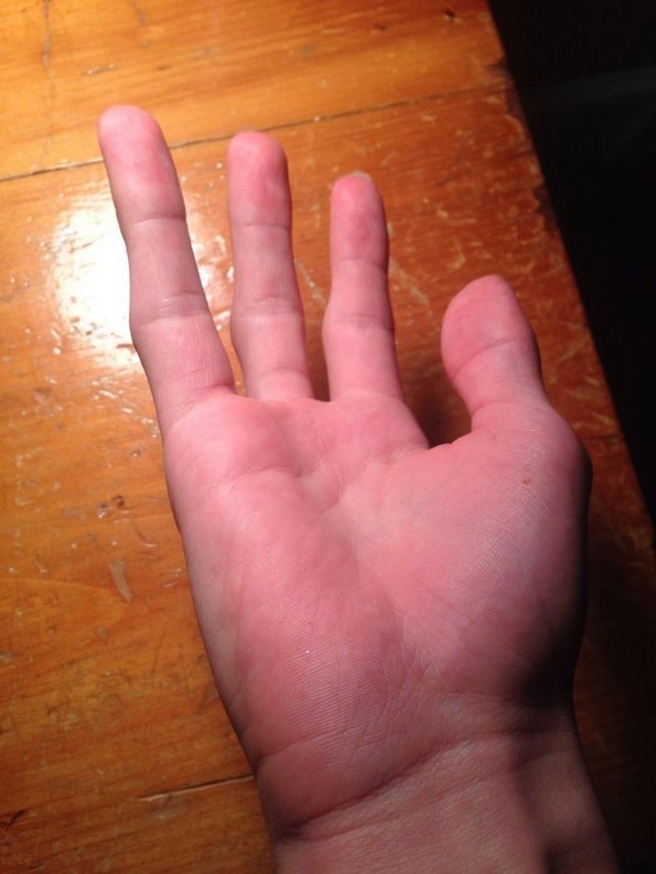 Луѓе споделуваат фотографии од нивните необични делови на телото