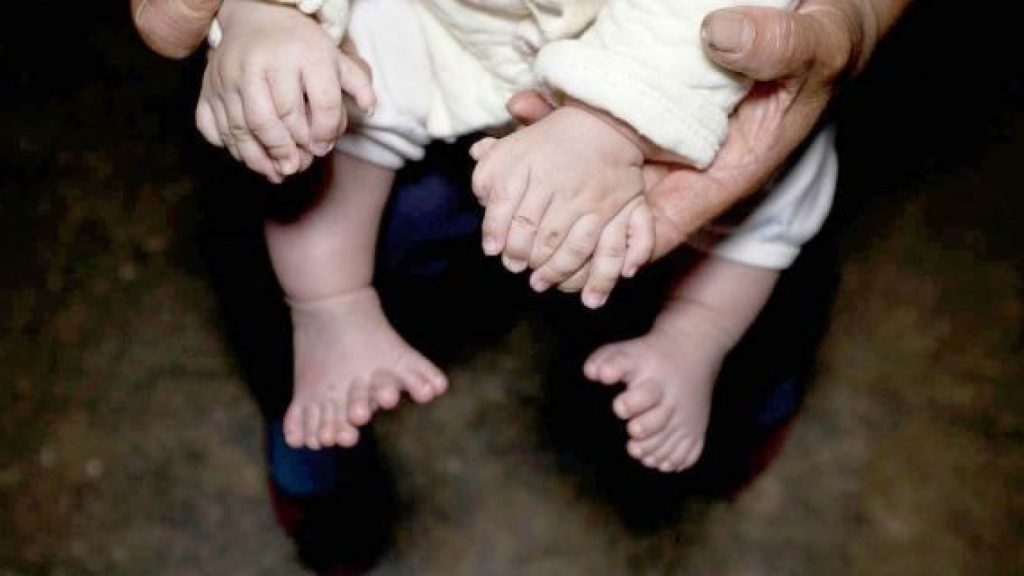 Луѓе споделуваат фотографии од нивните необични делови на телото