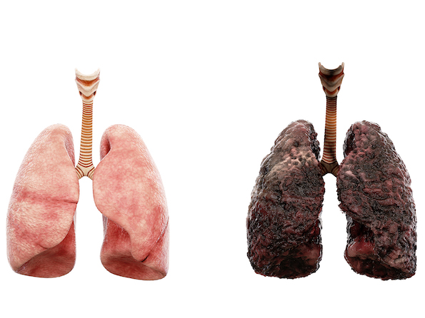 Како без кризи и нервози на 100% природен начин да се убие желбата за никотин и засекогаш да се откажете од пушење? Nil Smoke