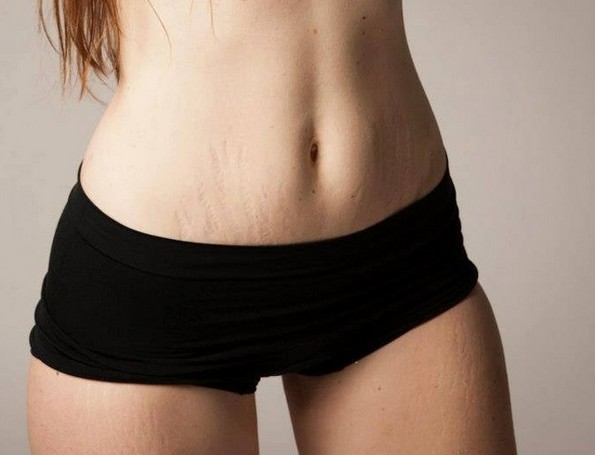 Фотограф покажува како навистина изгледа женското тело по бременост