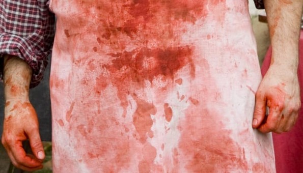 10 ужасни факти за хирургијата во Викторијанската ера