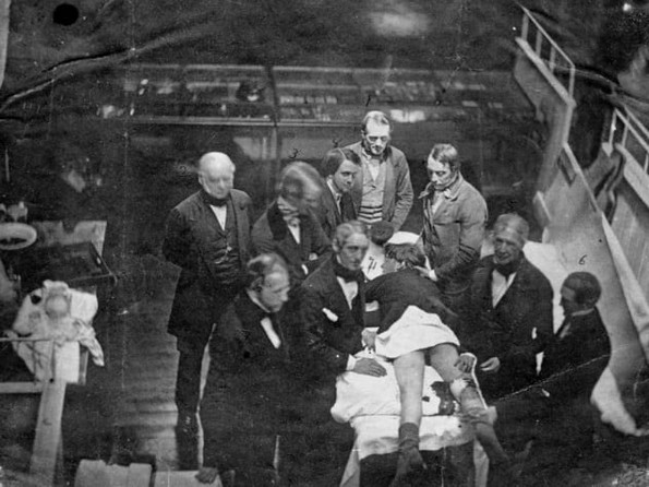10 ужасни факти за хирургијата во Викторијанската ера