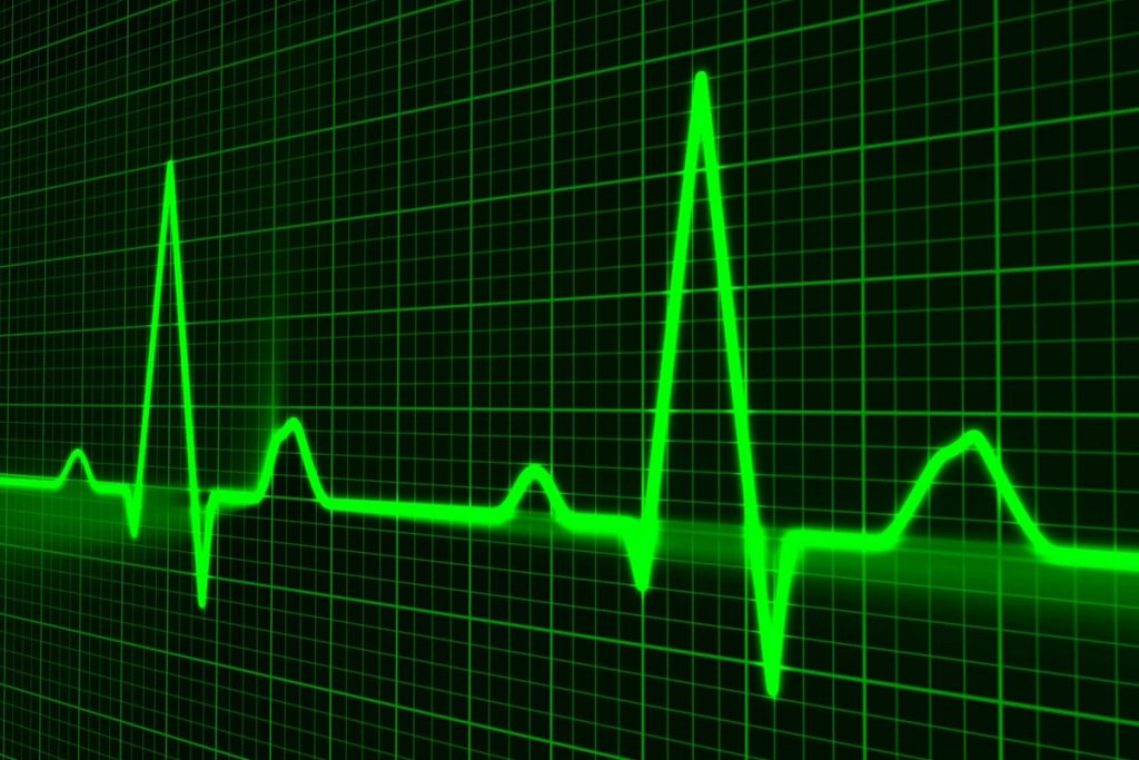 Што значи кога вашиот пулс е повисок или понизок од нормалната граница?