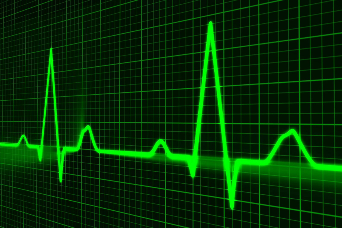 Што значи кога вашиот пулс е повисок или понизок од нормалната граница?