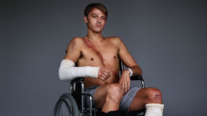 10 луѓе позираат со нивите повреди за да ја зголемат свесноста за безбедносниот појас