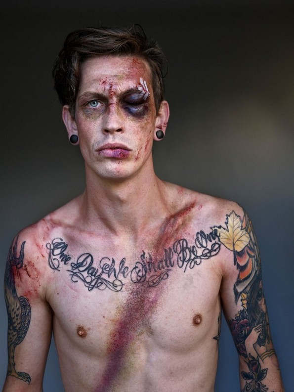 10 луѓе позираат со нивите повреди за да ја зголемат свесноста за безбедносниот појас