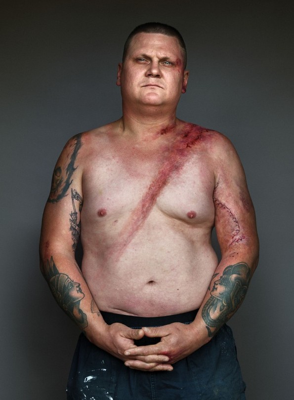 10 луѓе позираат со нивите повреди за да ја зголемат свесноста за безбедносниот појас