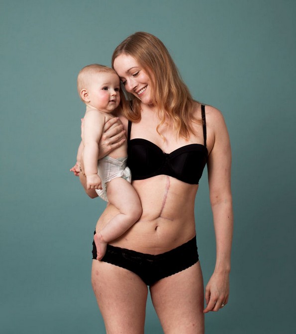Кампања што го слави телото на жената после бременост со цел да им стави крај на нереалните очекувања на новите мајки