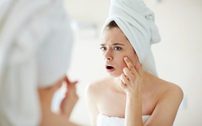 Мобилните телефони можат да предизвикаат акни и други проблеми со кожата на лицето