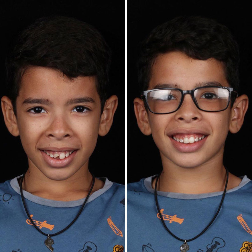 Стоматолог од Бразил патува низ светот и им ги поправа забите на луѓето кои не можат да си го дозволат тоа