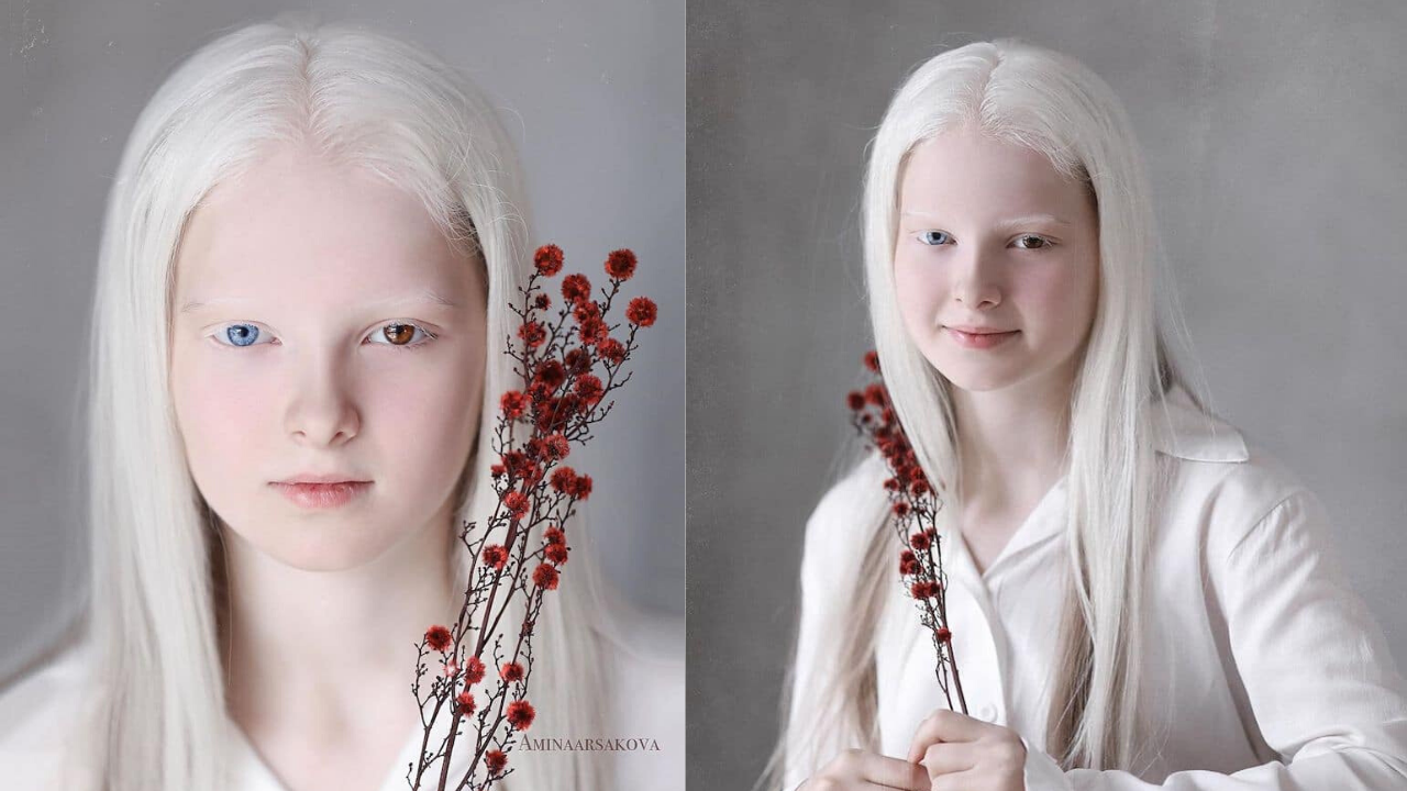Портрети кои ја истакнуваат уникатната убавина на една девојка со албинизам и хетерохромија