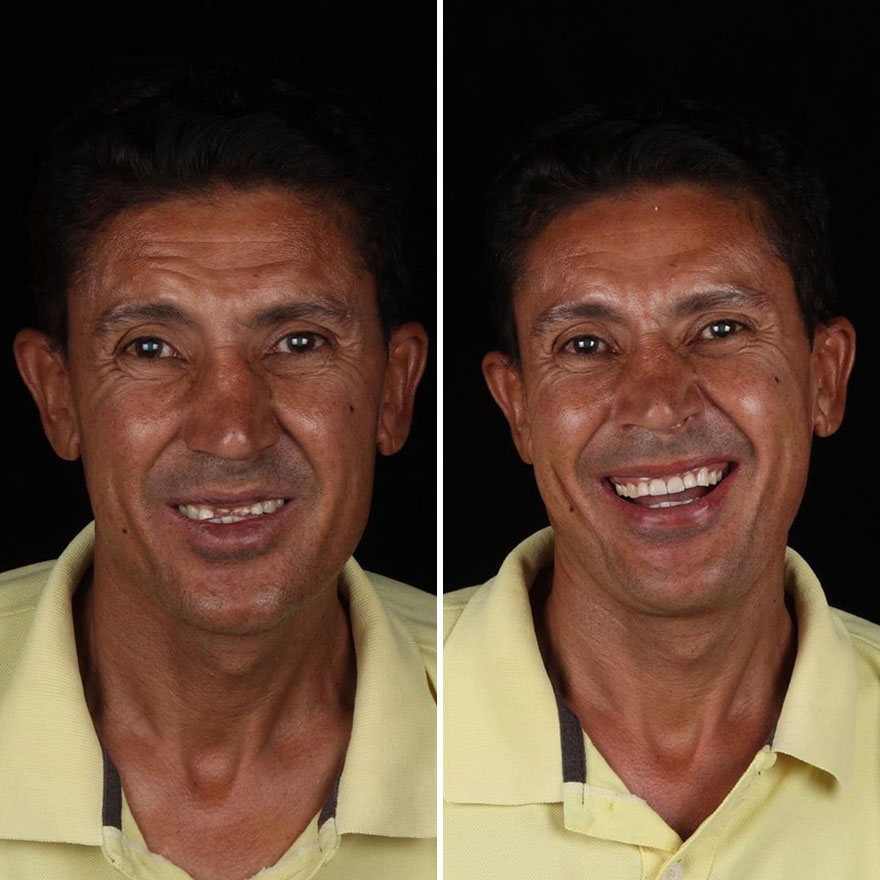 Стоматолог од Бразил патува низ светот и им ги поправа забите на луѓето кои не можат да си го дозволат тоа