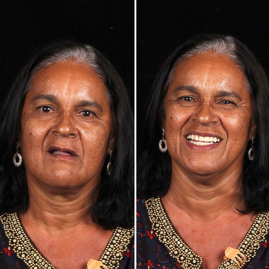 Стоматолог од Бразил патува низ светот и им ги поправа забите на луѓето кои не можат да си го дозволат тоа