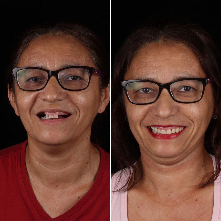 Стоматолог од Бразил патува низ светот и им ги поправа забите на луѓето кои не можат да си го дозволат тоа